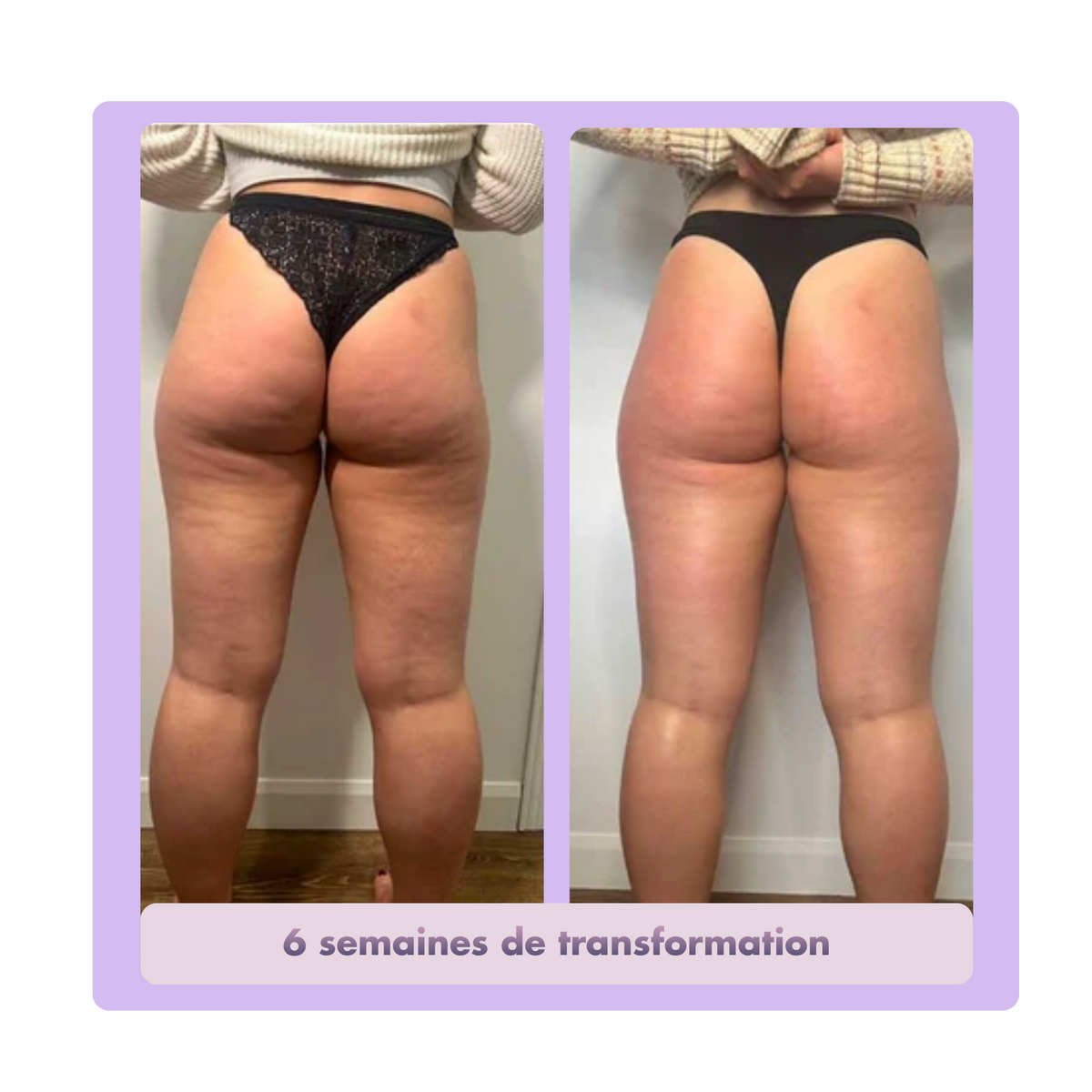 Legging Anti-Cellulite