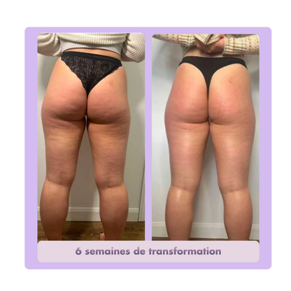Legging Anti-Cellulite