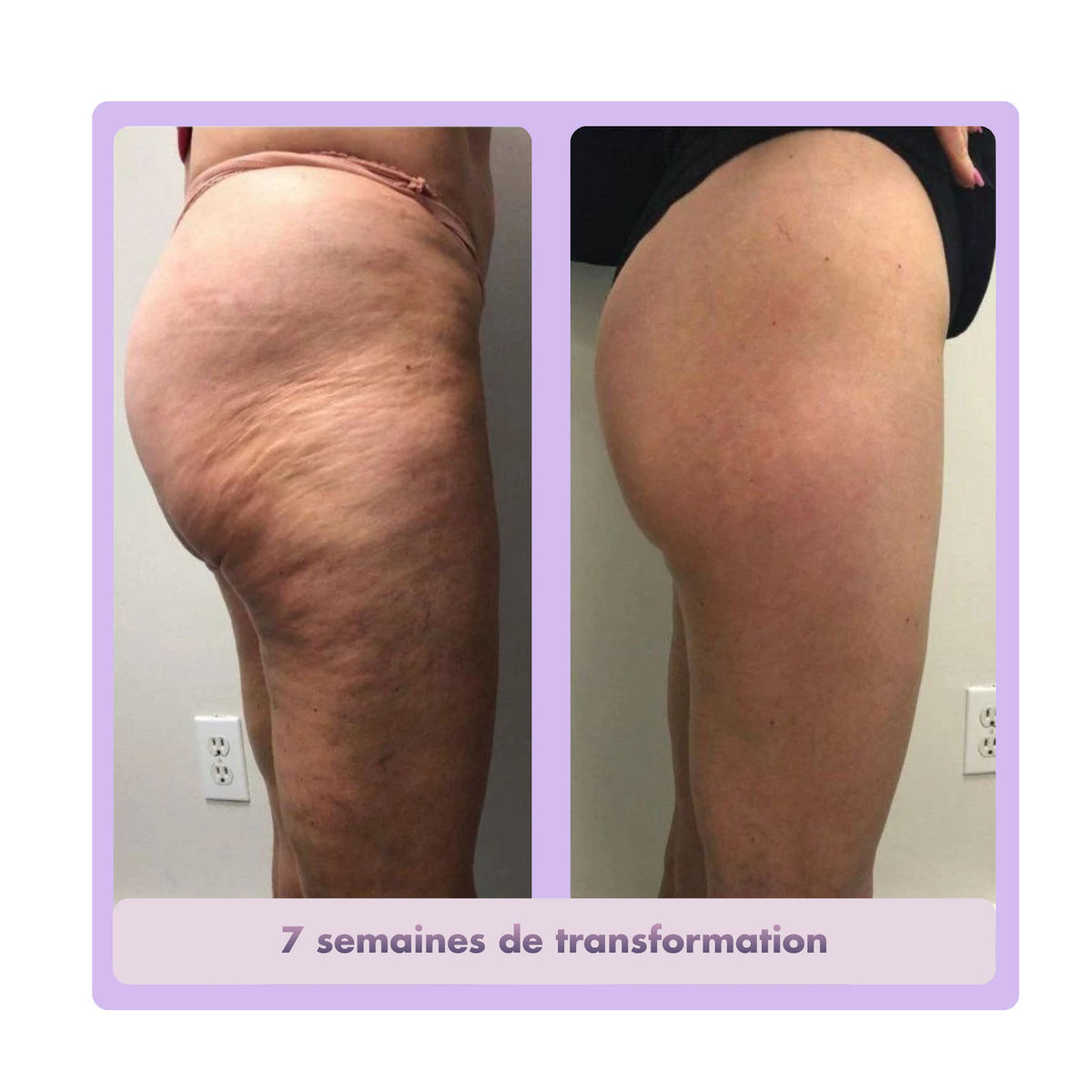 Legging Anti-Cellulite