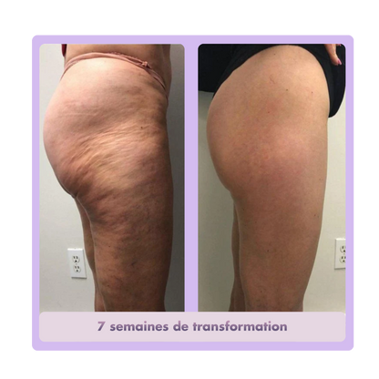 Legging Anti-Cellulite